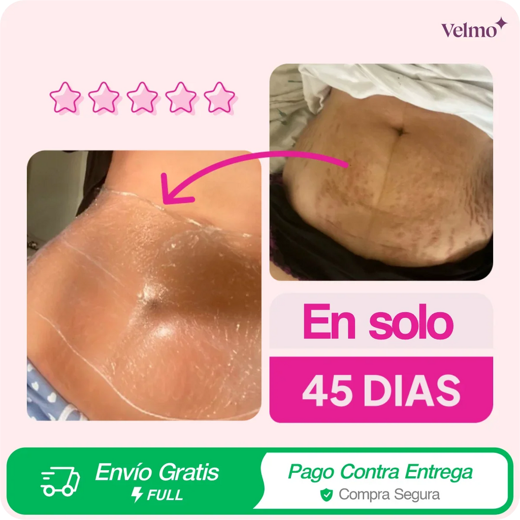 Crema ADEUS Rosa | Anti Estrías